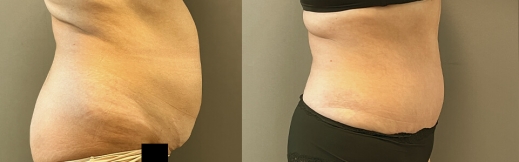 42-ימין-מתיחת בטן