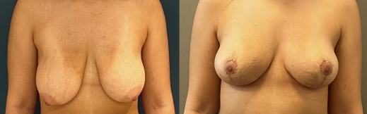 הקטנה - 23 הקטנה - 23